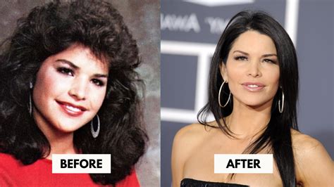 lauren sanchez before surgery